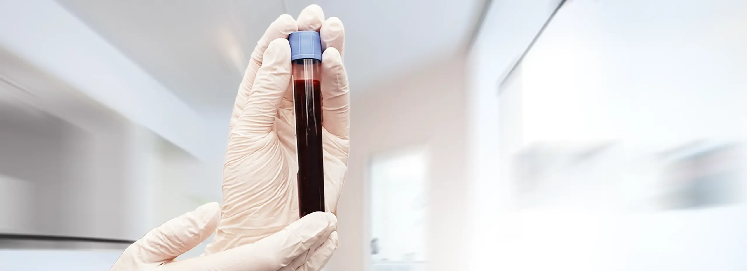 Eigenbluttherapie beim Zahnarzt